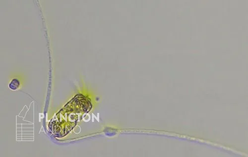 Chaetoceros convolutus - Imagen 3