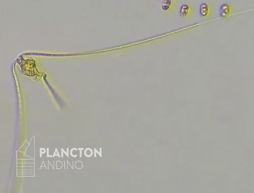 Chaetoceros convolutus - Imagen 4