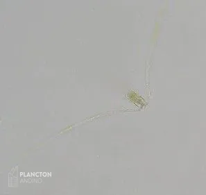 Chaetoceros convolutus - Imagen 1