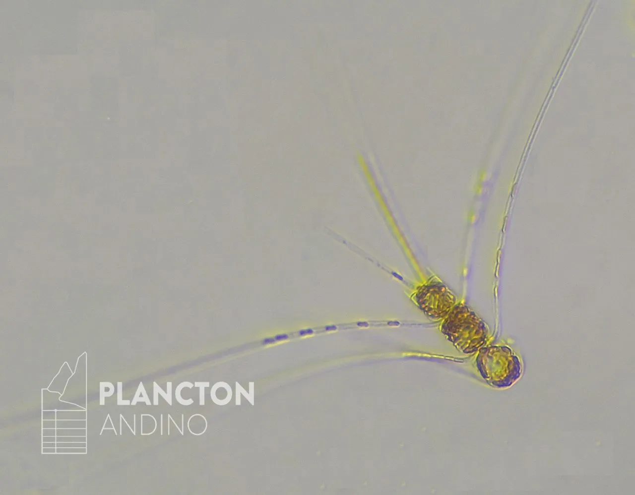 Chaetoceros criophilus - Imagen 1