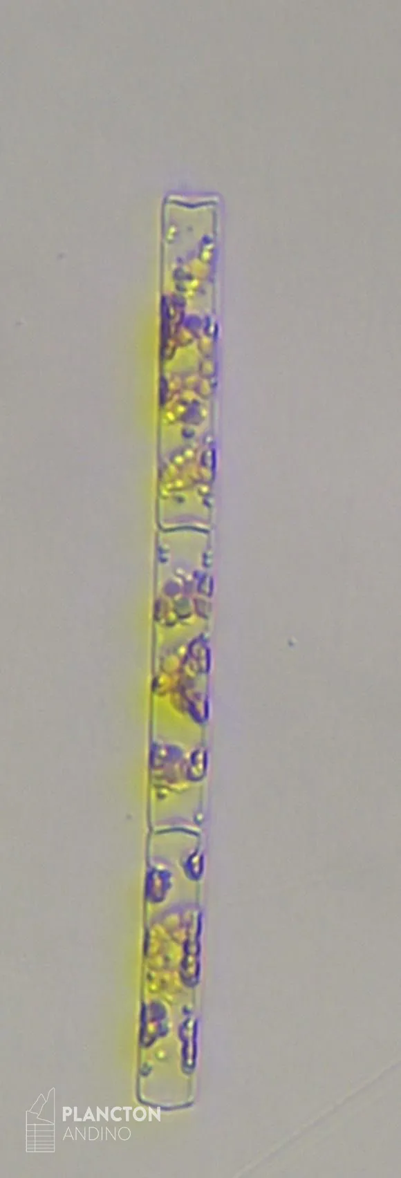 Leptocylindrus danicus - Imagen 3