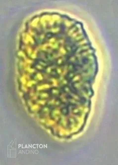 Pseudochattonella verruculosa - Imagen 1