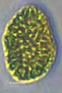 Pseudochattonella verruculosa - Imagen 2