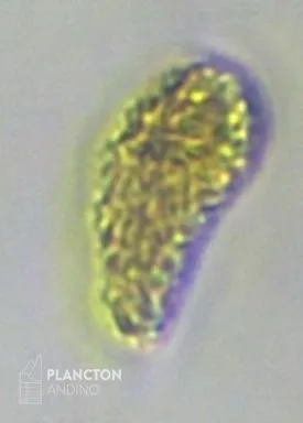 Pseudochattonella verruculosa - Imagen 3