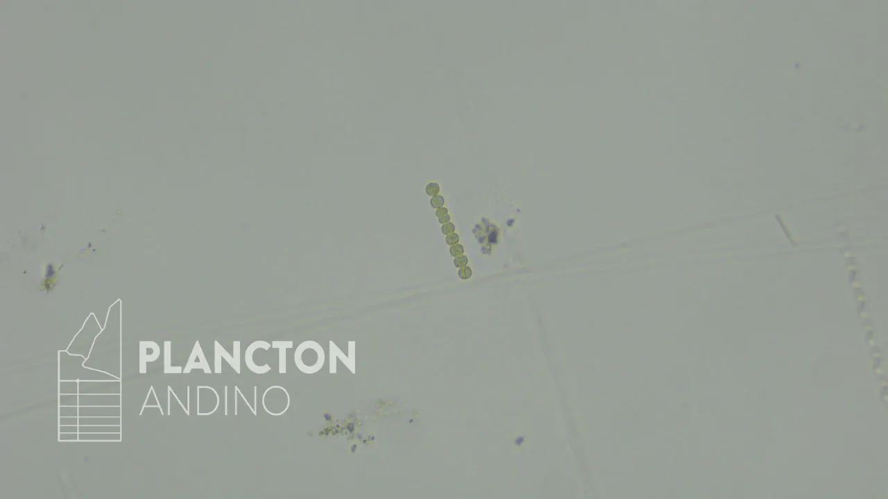 Dolichospermum - Imagen 1