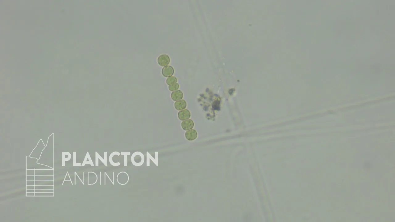 Dolichospermum - Imagen 2