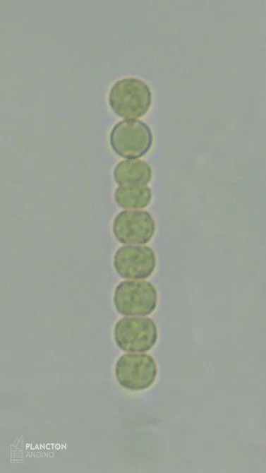 Dolichospermum - Imagen 2