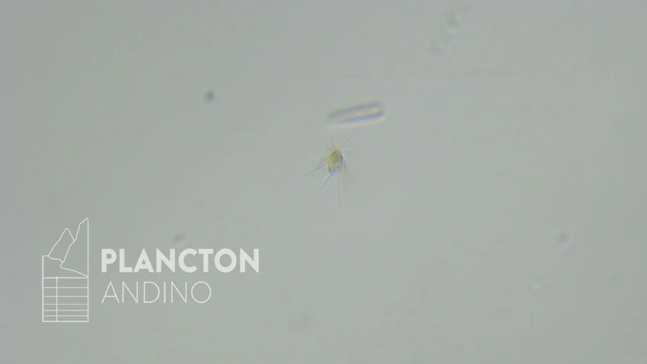 Mallomonas - Imagen 1