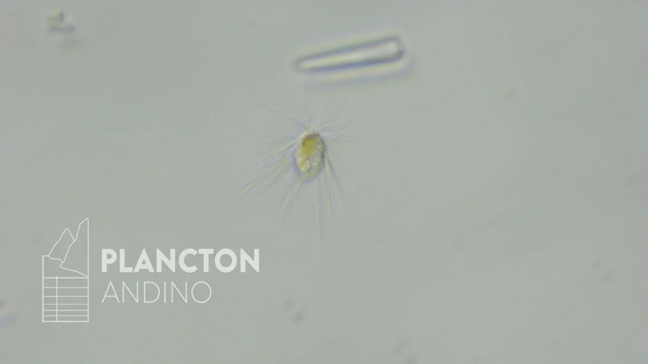 Mallomonas - Imagen 2