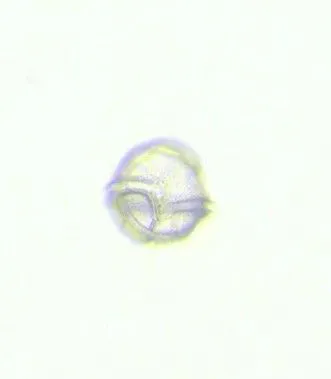 Peridinium - Imagen 2