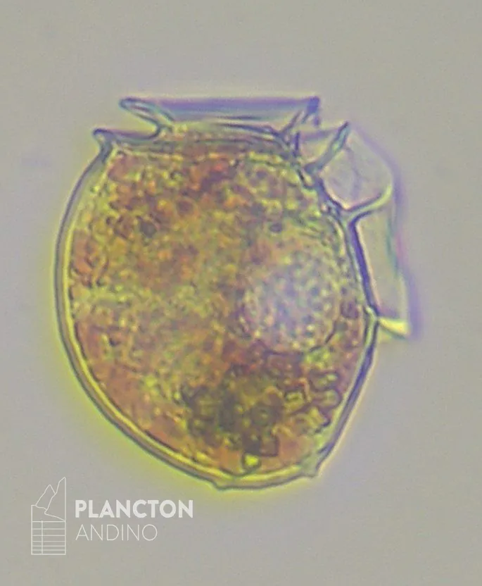 Dinophysis acuminata - Imagen 2