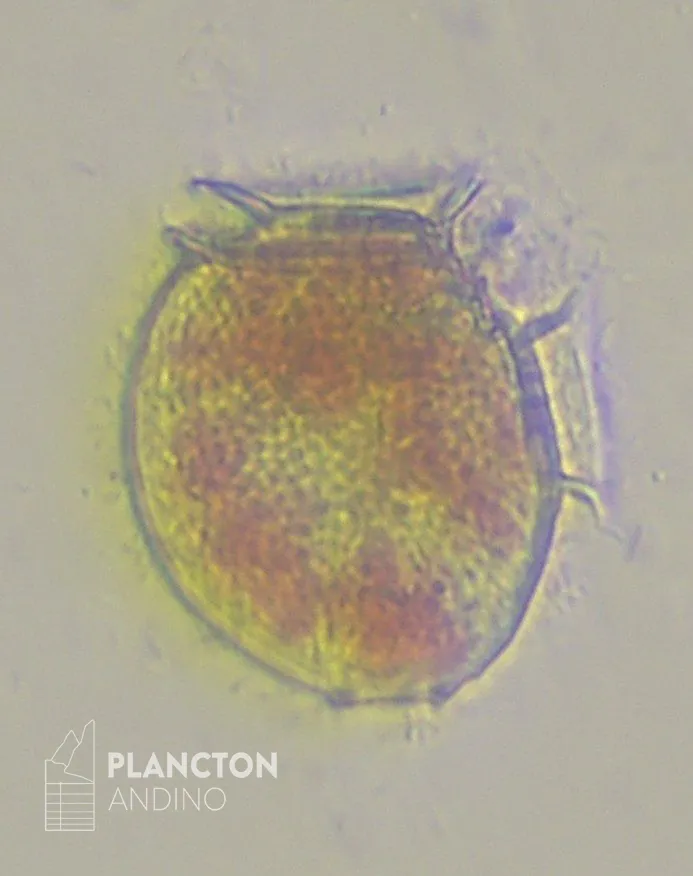 Dinophysis acuminata - Imagen 3