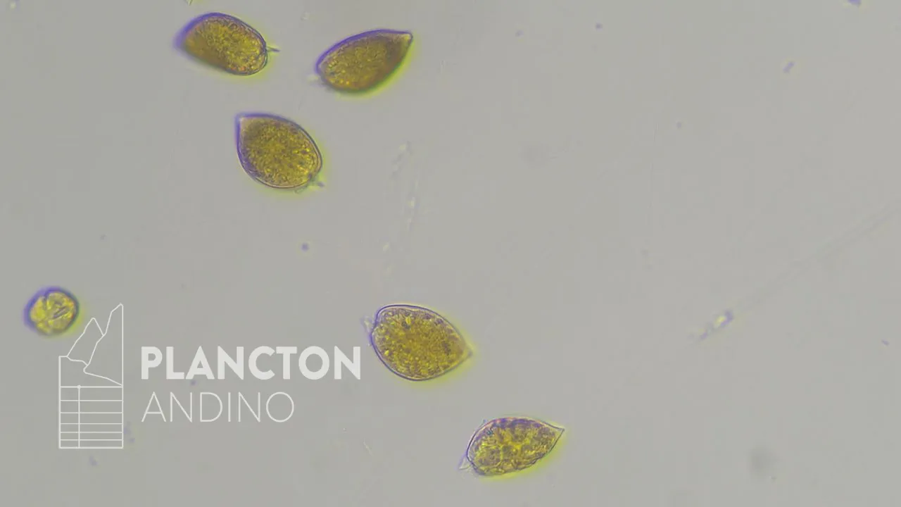 Prorocentrum micans - Imagen 2