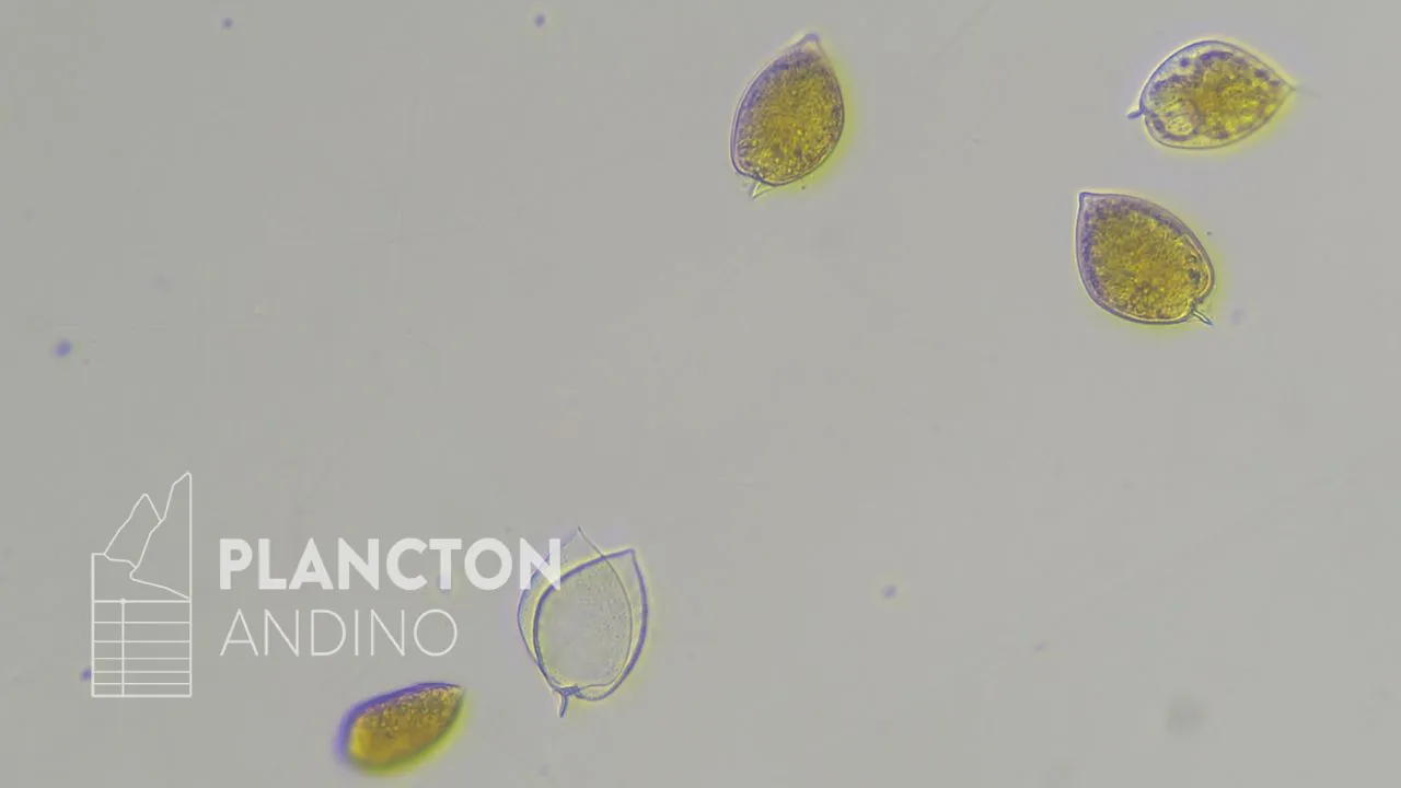 Prorocentrum micans - Imagen 1