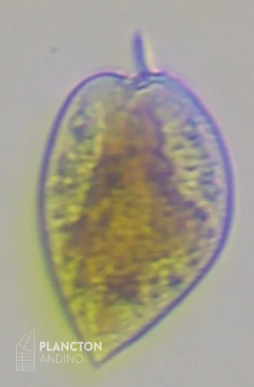 Prorocentrum micans - Imagen 4