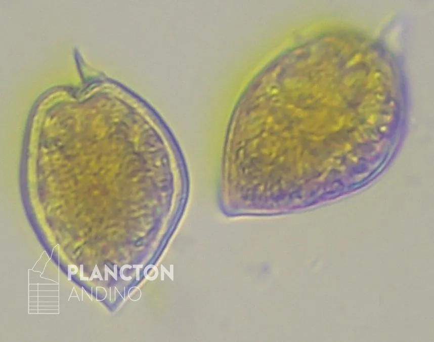 Prorocentrum micans - Imagen 3