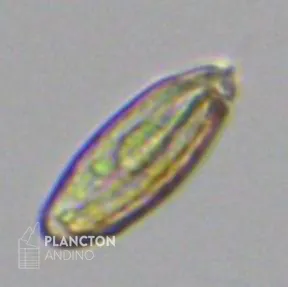 Torodinium - Imagen 3