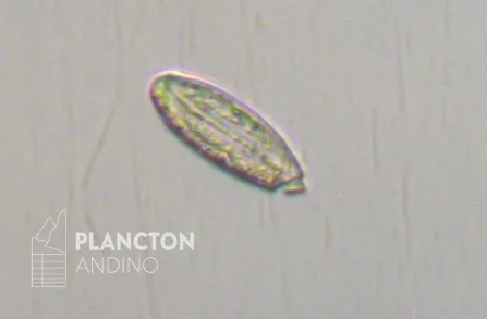 Torodinium - Imagen 2