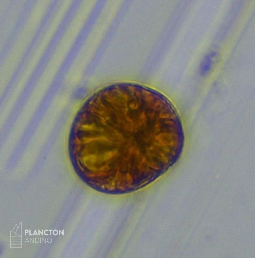 Alexandrium catenella - Imagen 3