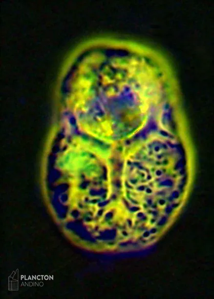 Ebria tripartita - Imagen 3