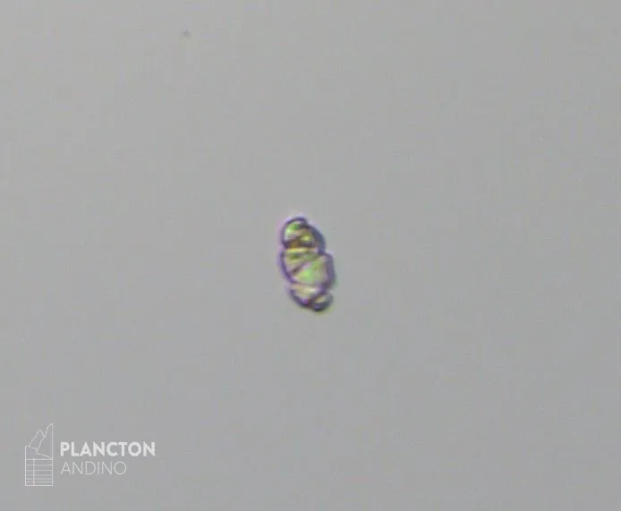 Cochlodinium - Imagen 2