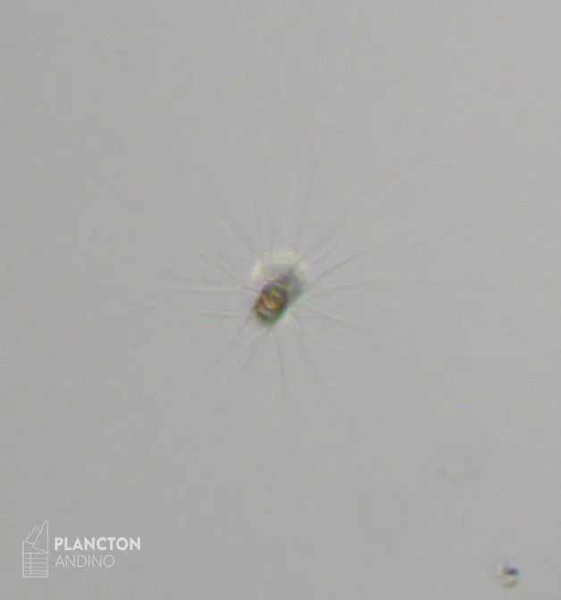 Bacteriastrum - Imagen 2