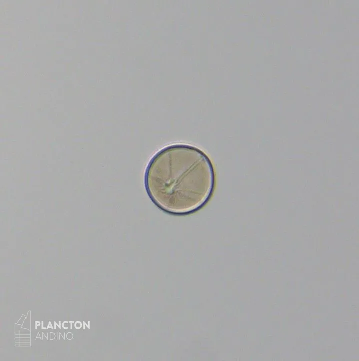 Asteromphalus - Imagen 1