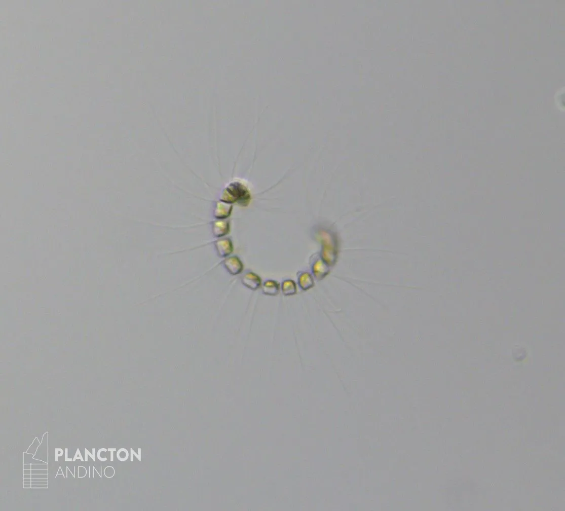 Chaetoceros curvisetus - Imagen 4