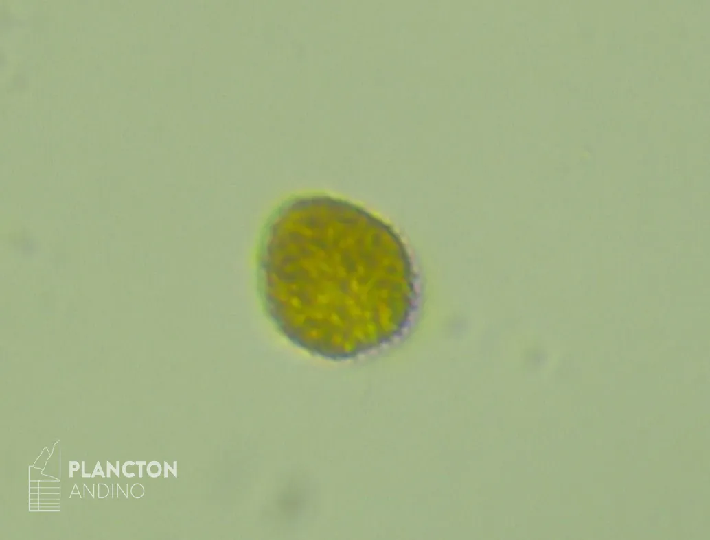 Pseudochattonella verruculosa - Imagen 2