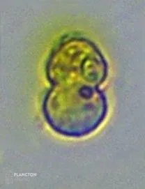 Dinophyceae - Imagen 2