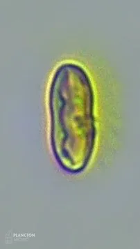 Bacillariophyceae - Imagen 1
