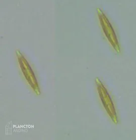 Bacillariophyceae - Imagen 2