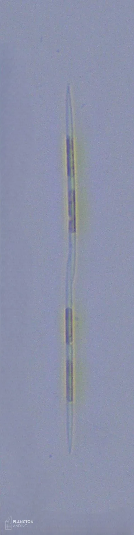 Pseudo-nitzschia - Imagen 4