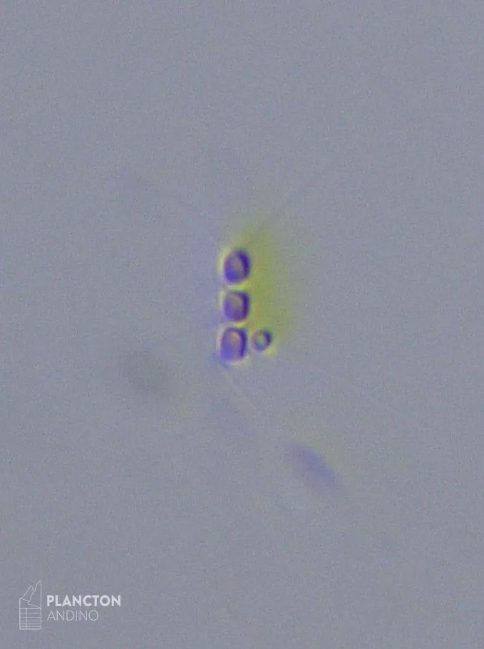 Chaetoceros