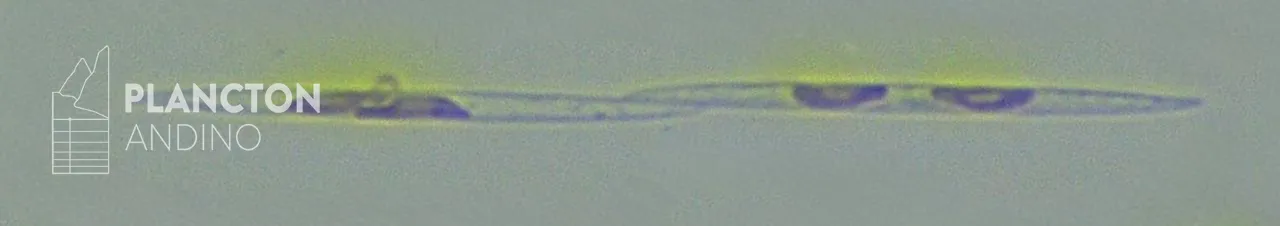 Pseudo-nitzschia - Imagen 1