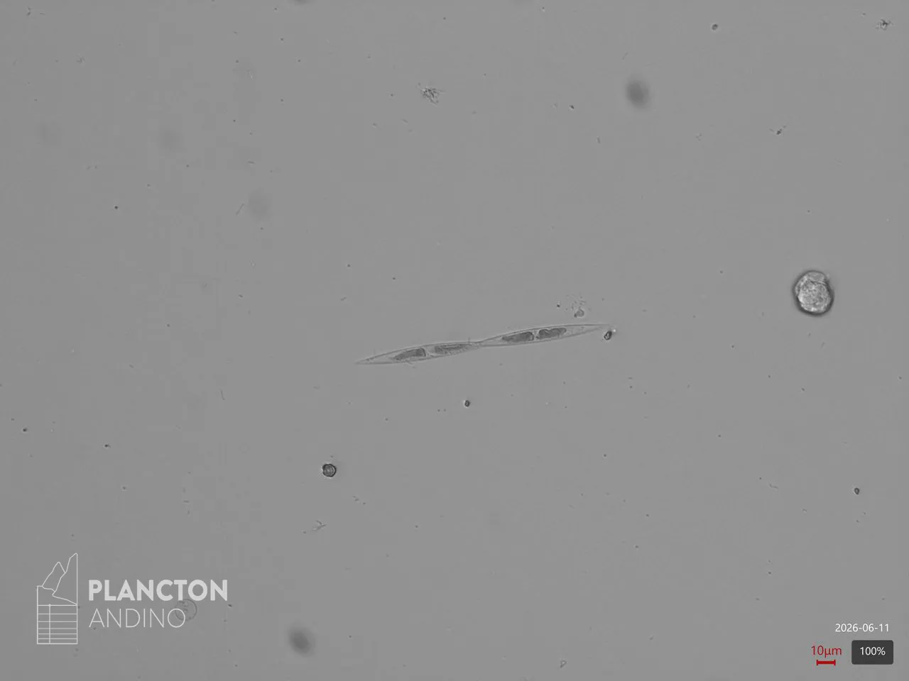 Pseudo-nitzschia - Imagen 3