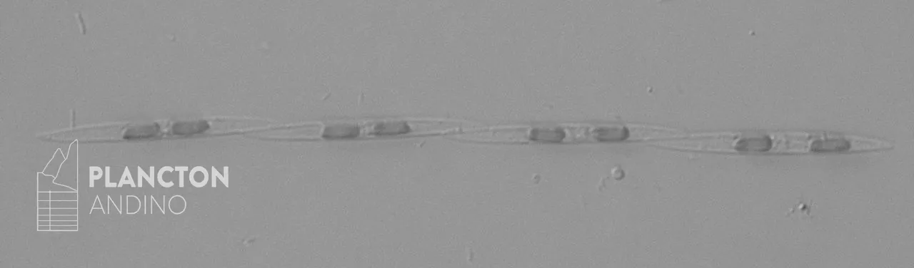 Pseudo-nitzschia - Imagen 2