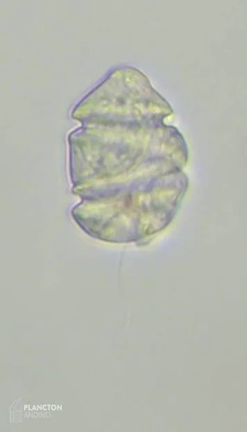 Cochlodinium