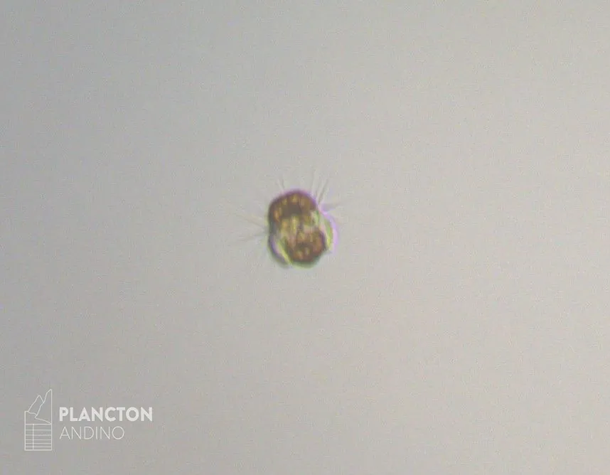 Mesodinium rubrum - Imagen 2