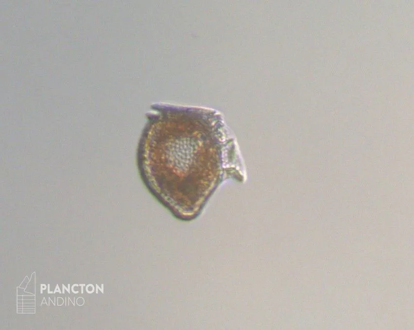 Dinophysis norvegica - Imagen 1