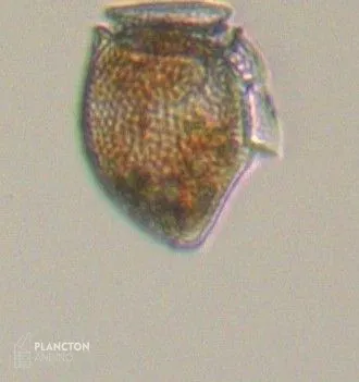 Dinophysis norvegica - Imagen 2