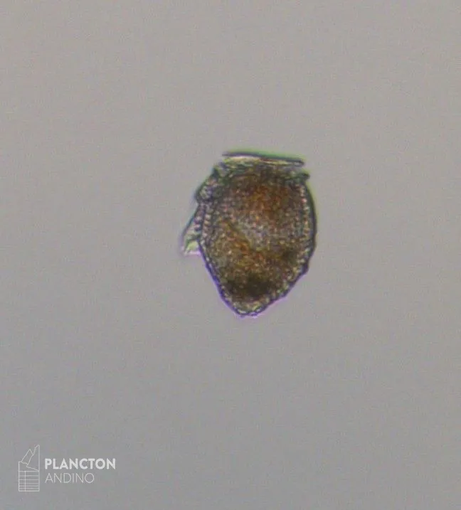 Dinophysis norvegica - Imagen 3