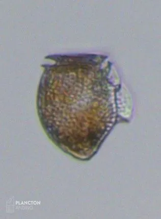 Dinophysis norvegica - Imagen 3