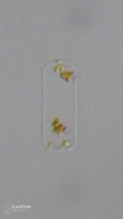 Cerataulina pelagica - Imagen 2