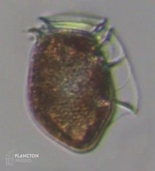 Dinophysis acuta - Imagen 2