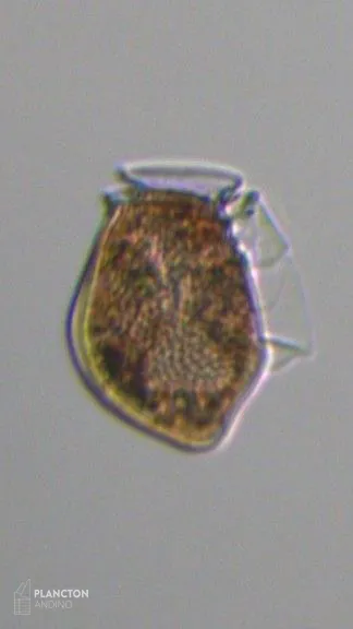 Dinophysis acuta - Imagen 3